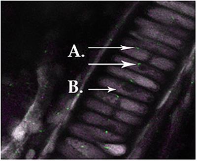 Osteoarthritis-Like Changes in Bardet–Biedl Syndrome Mutant Ciliopathy Mice (Bbs1M390R/M390R): Evidence for a Role of Primary Cilia in Cartilage Homeostasis and Regulation of Inflammation